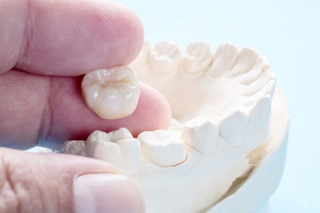 dental crown