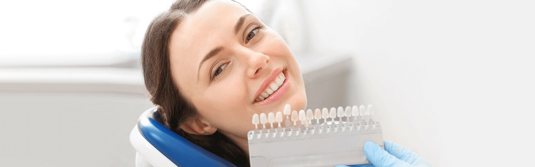 image of dental veneers