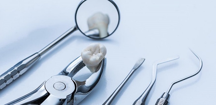 tooth extraction