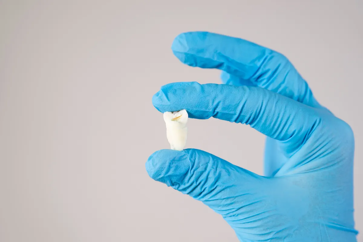 Why Choose Just Dental Clinic in Barrhaven?